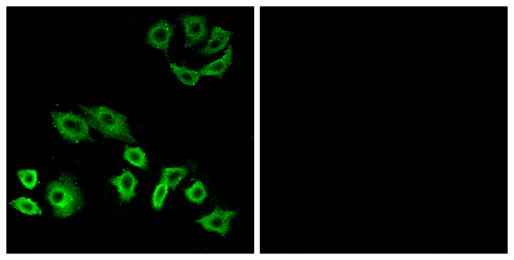 TTF / RHOH Antibody - Immunofluorescence analysis of A549 cells, using RhoH Antibody. The picture on the right is blocked with the synthesized peptide.