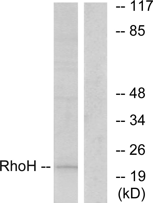TTF / RHOH Antibody - Western blot analysis of lysates from HT-29 cells, using RhoH Antibody. The lane on the right is blocked with the synthesized peptide.