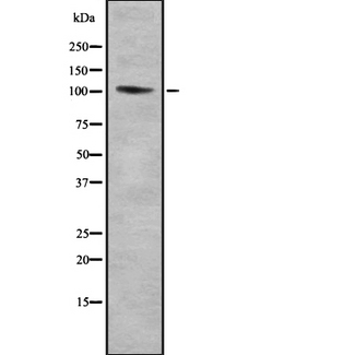 TTF1 / Txn Termination Factor Antibody - Western blot analysis of TTF1 using HepG2 whole cells lysates