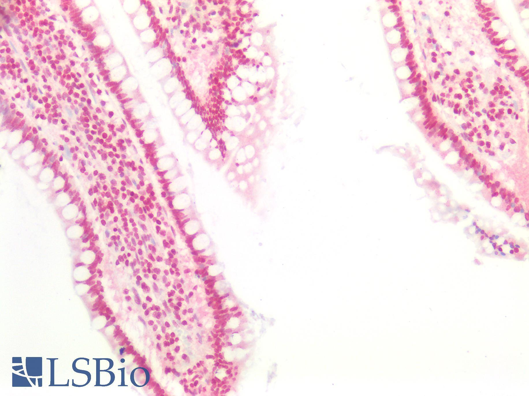 TTF1 / Txn Termination Factor Antibody - Human Small Intestine: Formalin-Fixed, Paraffin-Embedded (FFPE)