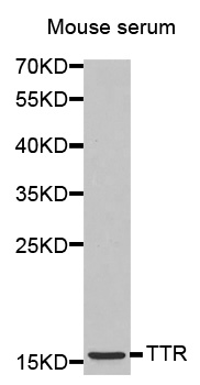 TTR / Transthyretin Antibody - Western blot (WB) analysis of TTR polyclonal antibody