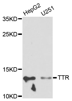 TTR / Transthyretin Antibody - Western blot analysis of extracts of various cell lines, using TTR antibody at 1:1000 dilution. The secondary antibody used was an HRP Goat Anti-Rabbit IgG (H+L) at 1:10000 dilution. Lysates were loaded 25ug per lane and 3% nonfat dry milk in TBST was used for blocking. An ECL Kit was used for detection and the exposure time was 30s.
