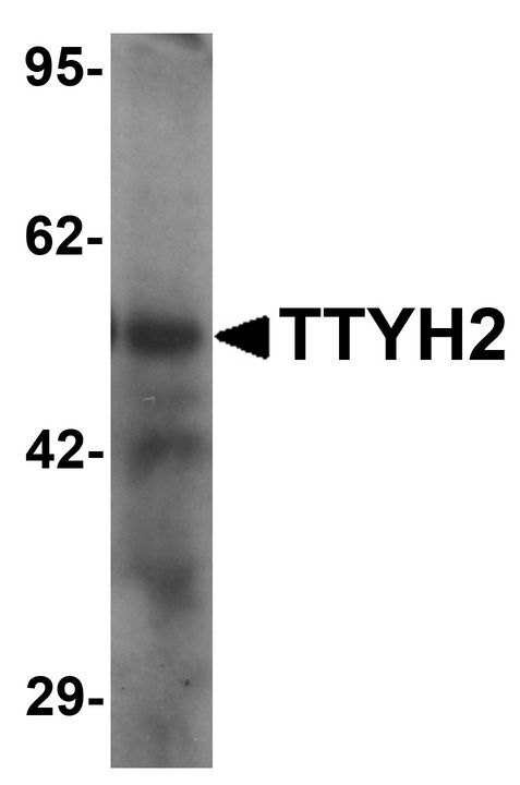 TTYH2 Antibody - Western blot analysis of TTYH2 in human kidney tissue lysate with TTYH2 antibody at 1 ug/ml