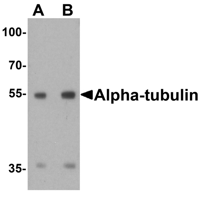 TUBA1A / Tubulin Alpha 1a Antibody - Western blot analysis of alpha-Tubulin in 293, Daudi, Hela, HepG2, Jurkat, K562, NH3T3, Raji, Ramos, U937, Human brain, Mouse brain, Rat Brain, Rabbit Brain, Rabbit Spleen, Zebrafish, Mouse Liver and Chicken liver lysate at 1 ug/mL.