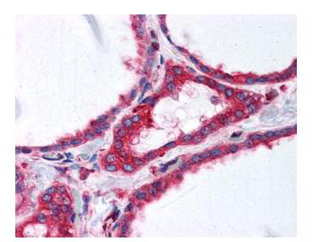 TUBA1B / Tubulin Alpha 1B Antibody - Anti-alpha-Tubulin Monoclonal Antibody - Immunohistochemistry. anti-a-tubulin monoclonal antibody was used at a 2.5 ug/mL to detect tubulin in thyroid follicular epithelium (40X) showing moderate to strong cytoplasmic staining (image). Moderate to strong cytoplasmic staining was also observed within subsets of neurons and glia, and epithelial cells including adrenal, breast, colon, pancreas, kidney, prostate, placenta, skin, testis, uterus, thyroid, and within lymphoid organs. The image shows the localization of the antibody as the precipitated red signal, with a hematoxylin purple nuclear counterstain. tissue was formalin-fixed and paraffin embedded.
