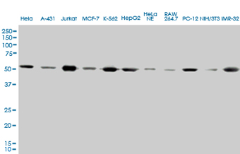 TUBA4A / TUBA1 Antibody - TUBA1 monoclonal antibody, clone 2E11. Western blot of TUBA1 expression in different Cell lines and Human Tissue.