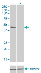 TUBA4A / TUBA1 Antibody - Western blot of TUBA1 over-expressed 293 cell line, cotransfected with TUBA1 Validated Chimera RNAi (Lane 2) or non-transfected control (Lane 1). Blot probed with TUBA1 monoclonal antibody, clone 2E11. GAPDH ( 36.1 kD ) used as specificity.