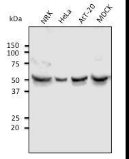 TUBA4A / TUBA1 Antibody - Anti-tubulin alpha4A antibody at 1:1000 dilution. Lysates at 100 ug per lane; Rabbit polyclonal to goat IgG (HRP) at 1:10000 dilution.
