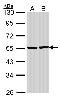TUBB / Beta Tubulin Antibody - Sample (30 ug of whole cell lysate). A:293T, B: H1299. 10% SDS PAGE. TUBB / Beta Tubulin antibody diluted at 1:3000.