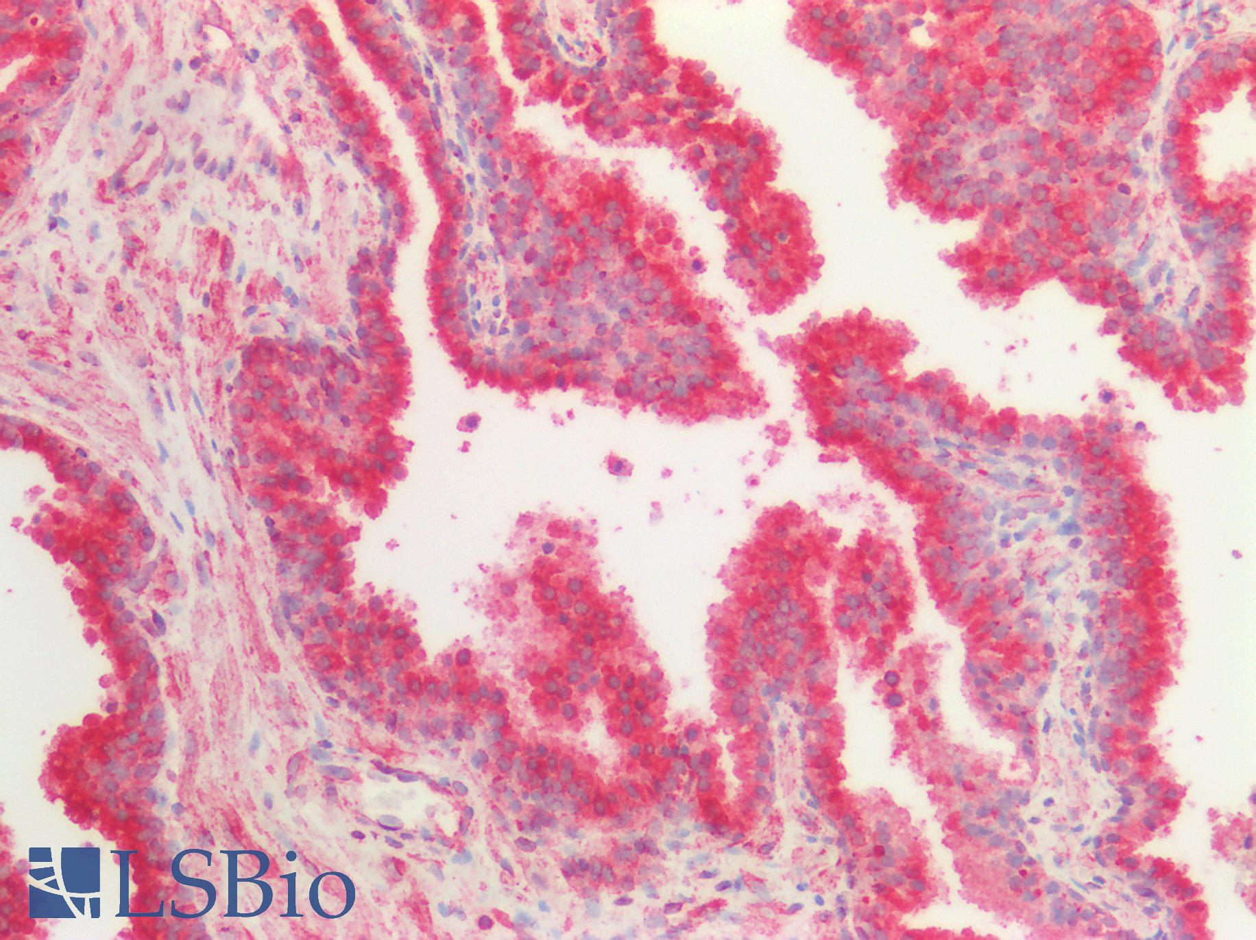 TUBB / Beta Tubulin Antibody - Human Prostate: Formalin-Fixed, Paraffin-Embedded (FFPE)