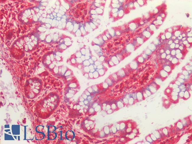 TUBB / Beta Tubulin Antibody - Human Small Intestine: Formalin-Fixed, Paraffin-Embedded (FFPE)