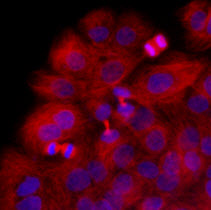 TUBB / Beta Tubulin Antibody - Immunofluorescence of HaCaT cells stained with Hoechst 3342 (Blue) for nucleus staining and monoclonal anti-human beta-Tubulin antibody (1:1000) with Texas Red (Red).