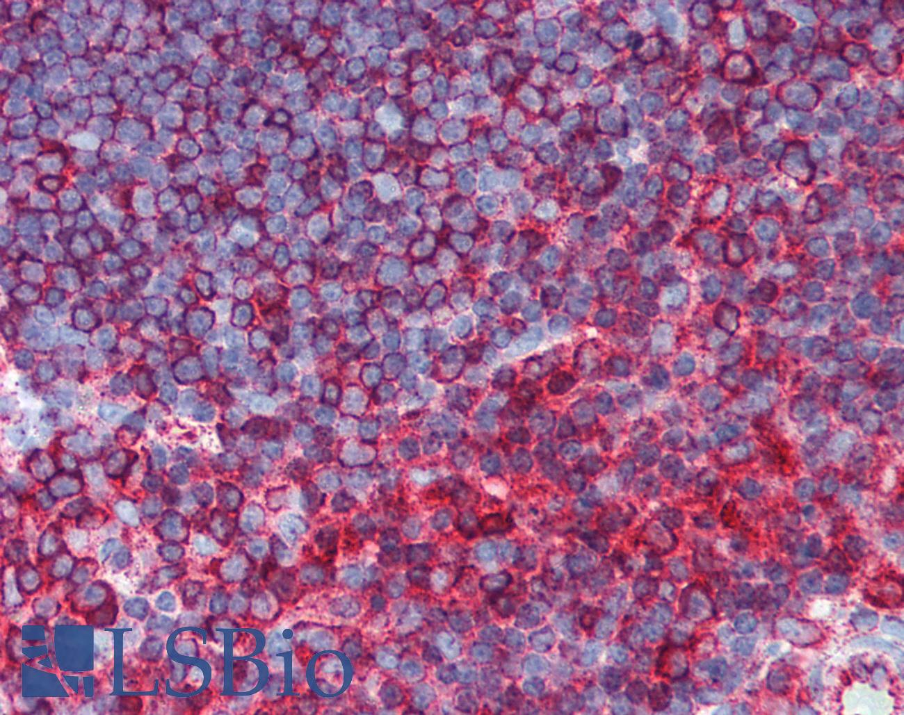TUBB / Beta Tubulin Antibody - Anti-TUBB / Tubulin, Beta antibody IHC of human thymus. Immunohistochemistry of formalin-fixed, paraffin-embedded tissue after heat-induced antigen retrieval. Antibody dilution 1:100. This image was taken for the unconjugated form of this product. Other forms have not been tested.