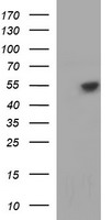 TUBB1 / Tubulin Beta 1 Antibody - HEK293T cells were transfected with the pCMV6-ENTRY control (Left lane) or pCMV6-ENTRY TUBB1 (Right lane) cDNA for 48 hrs and lysed. Equivalent amounts of cell lysates (5 ug per lane) were separated by SDS-PAGE and immunoblotted with anti-TUBB1.