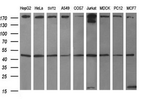 TUBB1 / Tubulin Beta 1 Antibody - Western blot of extracts (35ug) from 9 different cell lines by using anti-TUBB1 monoclonal antibody (HepG2: human; HeLa: human; SVT2: mouse; A549: human; COS7: monkey; Jurkat: human; MDCK: canine; PC12: rat; MCF7: human).