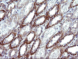 TUBB1 / Tubulin Beta 1 Antibody - IHC of paraffin-embedded Human Kidney tissue using anti-TUBB1 mouse monoclonal antibody. (Heat-induced epitope retrieval by 10mM citric buffer, pH6.0, 120°C for 3min), at a dilution of 1:150.