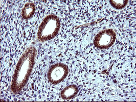 TUBB1 / Tubulin Beta 1 Antibody - IHC of paraffin-embedded Human endometrium tissue using anti-TUBB1 mouse monoclonal antibody. (Heat-induced epitope retrieval by 10mM citric buffer, pH6.0, 120°C for 3min), at a dilution of 1:150.