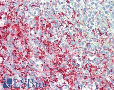 TUBB1 / Tubulin Beta 1 Antibody - Human Spleen: Formalin-Fixed, Paraffin-Embedded (FFPE), at a concentration of 10 ug/ml. 