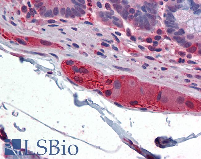 TUBB2A / Tubulin Beta 2A Antibody - Anti-TUBB2A antibody IHC of human small intestine, submucosal plexus. Immunohistochemistry of formalin-fixed, paraffin-embedded tissue after heat-induced antigen retrieval. Antibody concentration 5 ug/ml.