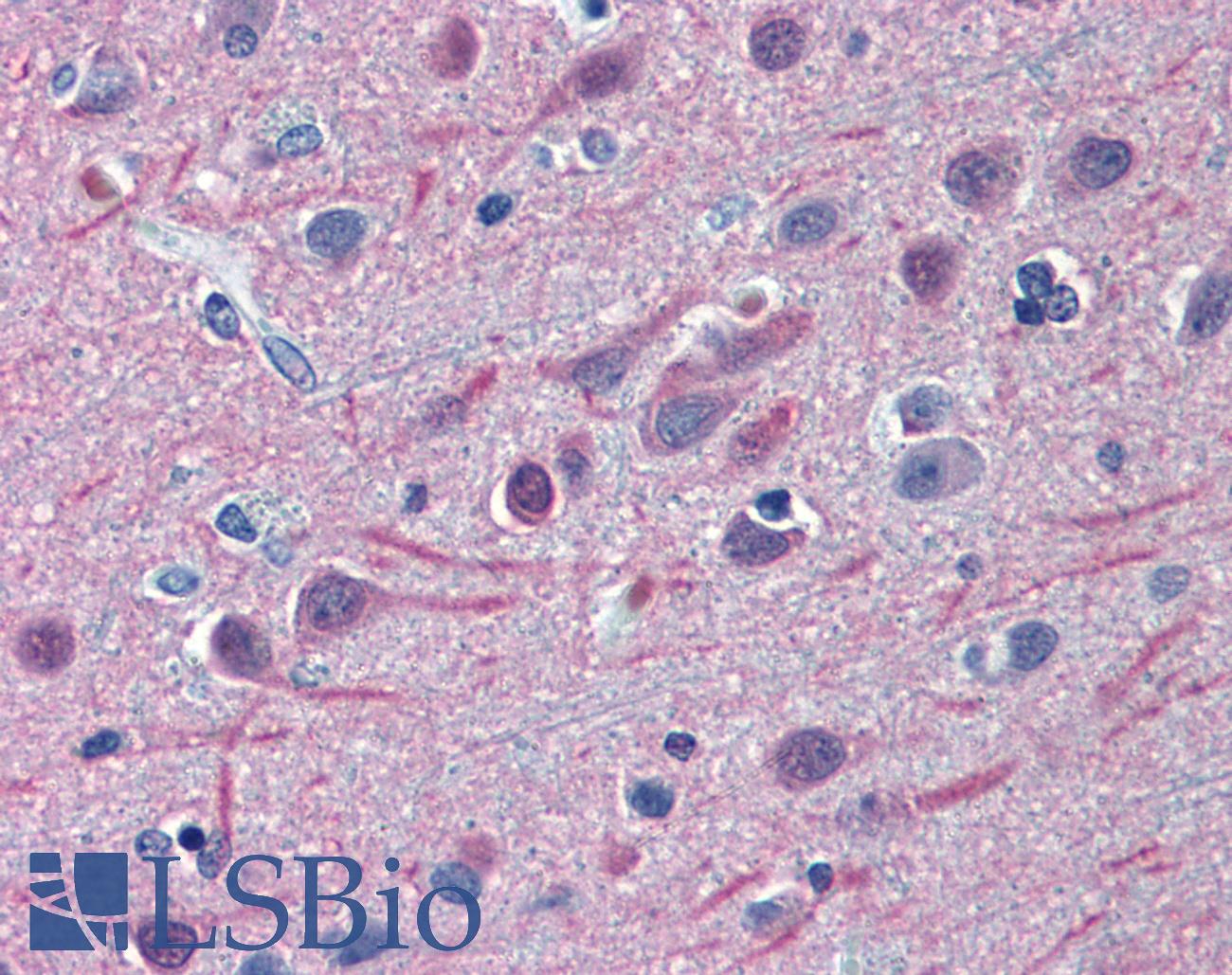 TUBB2A / Tubulin Beta 2A Antibody - Anti-TUBB2A antibody IHC of human brain, cortex. Immunohistochemistry of formalin-fixed, paraffin-embedded tissue after heat-induced antigen retrieval. Antibody concentration 2.5 ug/ml.