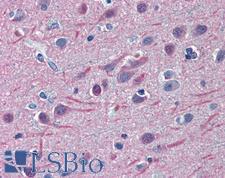 TUBB2A / Tubulin Beta 2A Antibody - Anti-TUBB2A antibody IHC of human brain, cortex. Immunohistochemistry of formalin-fixed, paraffin-embedded tissue after heat-induced antigen retrieval. Antibody concentration 2.5 ug/ml.