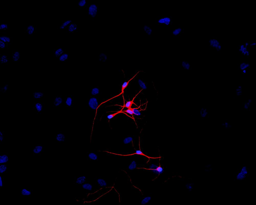 TUBB3 / Tubulin Beta 3 Antibody - Immunofluorescence staining of P-19 mouse embryonal carcinoma cell line stimulated to neuronal differentiation by retinoic acid.  A - Microtubules decorated with neuron-specific anti-betaIII-tubulin (TU-20; red).  B - Merged image of co-staining with anti-beta-tubulin (TU-06; green).  Superposition of red and green colours provided yellow staining. Nuclei were stained with DNA-binding dye (blue).