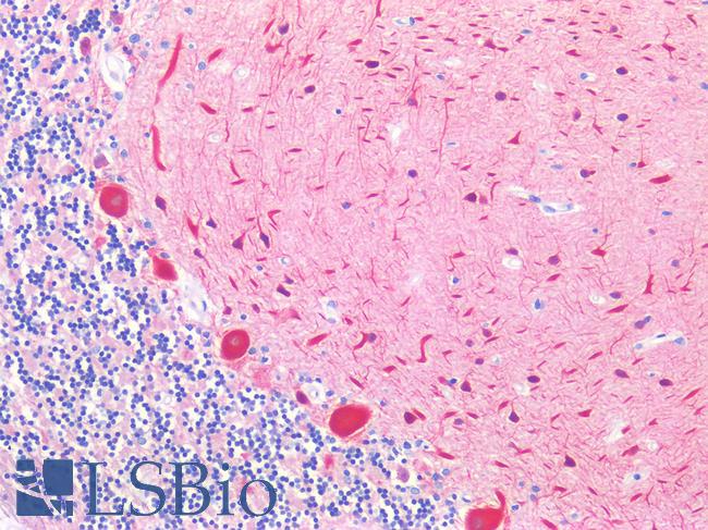 TUBB3 / Tubulin Beta 3 Antibody - Human Brain, Cerebellum: Formalin-Fixed, Paraffin-Embedded (FFPE)