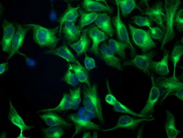 TUBB4 / Tubulin Beta 4 Antibody - Immunofluorescent staining of HeLa cells using anti-TUBB4 mouse monoclonal antibody.