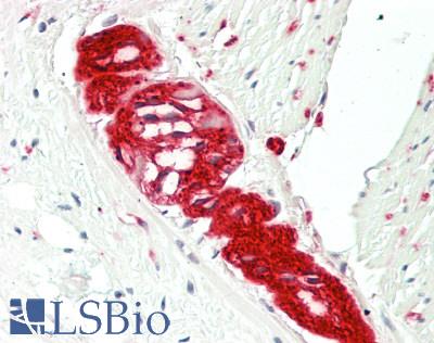 TUBB4 / Tubulin Beta 4 Antibody - Human Small Intestine, Myenteric Plexus: Formalin-Fixed, Paraffin-Embedded (FFPE)