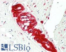 TUBB4 / Tubulin Beta 4 Antibody - Human Small Intestine, Myenteric Plexus: Formalin-Fixed, Paraffin-Embedded (FFPE)