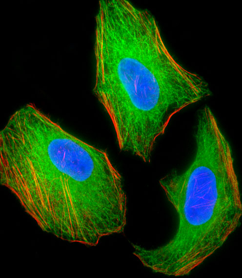 Tuberin / TSC2 Antibody - Fluorescent image of HeLa cell stained with TSC2 Antibody. HeLa cells were fixed with 4% PFA (20 min), permeabilized with Triton X-100 (0.1%, 10 min), then incubated with TSC2 primary antibody (1:25, 1 h at 37°C). For secondary antibody, Alexa Fluor 488 conjugated donkey anti-mouse antibody (green) was used (1:400, 50 min at 37°C). Cytoplasmic actin was counterstained with Alexa Fluor 555 (red) conjugated Phalloidin (7units/ml, 1 h at 37°C). Nuclei were counterstained with DAPI (blue) (10 ug/ml, 10 min). TSC2 immunoreactivity is localized to Microtubules significantly.