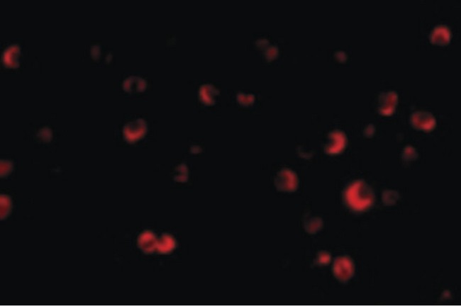 Tuberin / TSC2 Antibody - Immunofluorescence of TSC2 in L1210 cells with TSC2 antibody at 20 ug/ml.