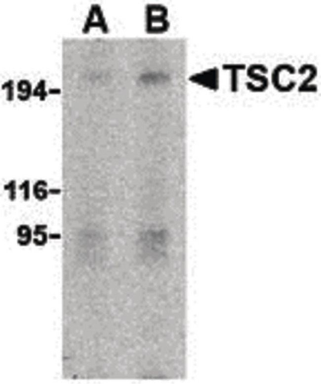 Tuberin / TSC2 Antibody - Western blot of TSC2 in L1210 cell lysate with TSC2 antibody at (A) 2 and (B) 4 ug/ml.