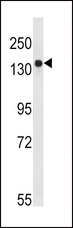 Tuberin / TSC2 Antibody - Western blot of TSC2-pS1798 in Ramos cell line lysates (35 ug/lane). TSC2 (arrow) was detected using the purified antibody.