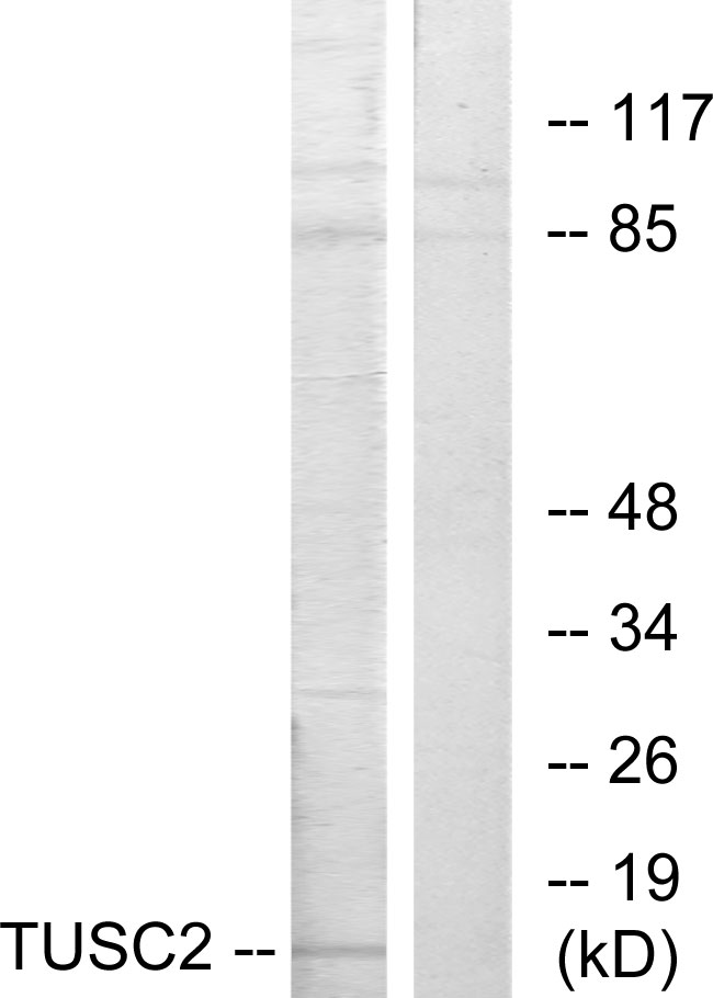 TUSC2 / FUS1 Antibody - Western blot analysis of lysates from HeLa cells, using TUSC2 Antibody. The lane on the right is blocked with the synthesized peptide.