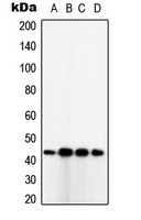 TUSC3 Antibody - Western blot analysis of TUSC3 expression in SKBR3 (A); HeLa (B); HepG2 (C); MDAMB231 (D) whole cell lysates.