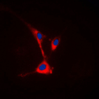 TUSC3 Antibody - Immunofluorescent analysis of TUSC3 staining in HeLa cells. Formalin-fixed cells were permeabilized with 0.1% Triton X-100 in TBS for 5-10 minutes and blocked with 3% BSA-PBS for 30 minutes at room temperature. Cells were probed with the primary antibody in 3% BSA-PBS and incubated overnight at 4 C in a humidified chamber. Cells were washed with PBST and incubated with a DyLight 594-conjugated secondary antibody (red) in PBS at room temperature in the dark. DAPI was used to stain the cell nuclei (blue).