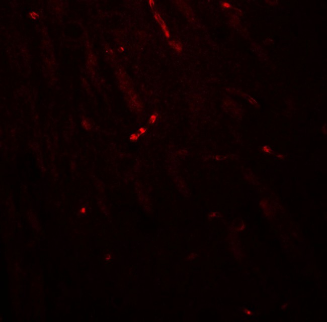 TWIK1 / KCNK1 Antibody - Immunofluorescence of KCNK1 in mouse brain tissue with KCNK1 antibody at 20 ug/ml.