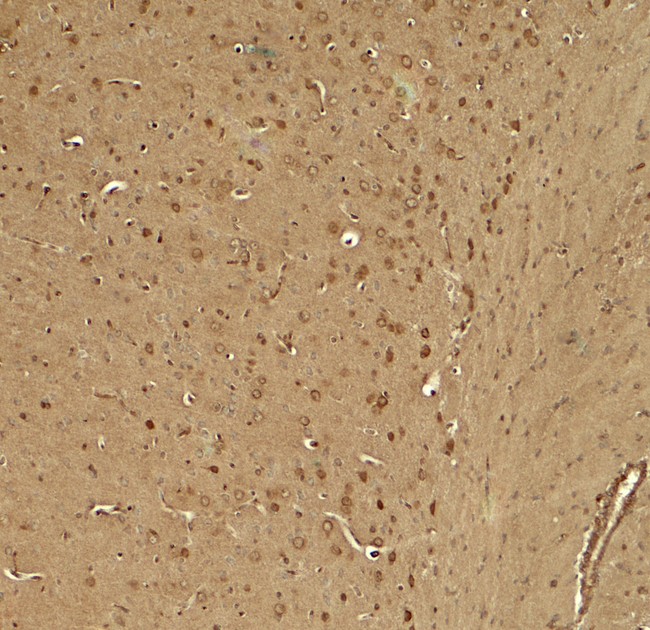 TWIK1 / KCNK1 Antibody - Immunohistochemistry of KCNK1 in mouse brain tissue with KCNK1 antibody at 5 ug/ml.