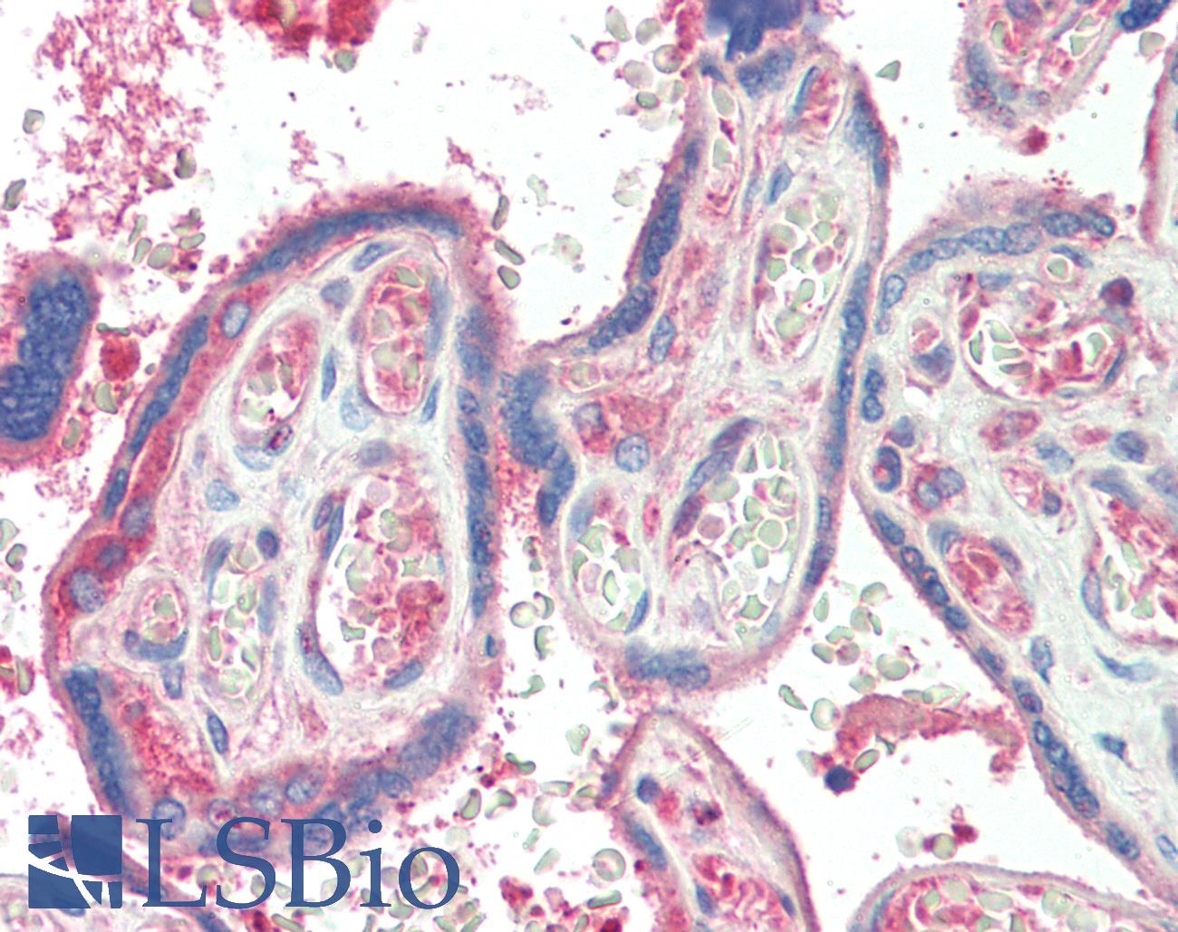 TXK / RLK Antibody - Anti-TXK / RLK antibody IHC staining of human placenta. Immunohistochemistry of formalin-fixed, paraffin-embedded tissue after heat-induced antigen retrieval. Antibody concentration 5 ug/ml.