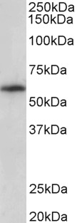 TXK / RLK Antibody - Goat Anti-TXK Antibody (0.3µg/ml) staining of Human Tonsil lysate (35µg protein in RIPA buffer). Primary incubation was 1 hour. Detected by chemiluminescencence.