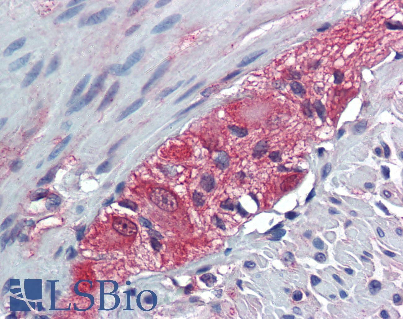 TXLNB Antibody - Anti-TXLNB antibody IHC of human colon, ganglion cells. Immunohistochemistry of formalin-fixed, paraffin-embedded tissue after heat-induced antigen retrieval.