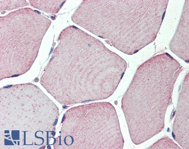 TXLNB Antibody - Anti-TXLNB antibody IHC of human skeletal muscle. Immunohistochemistry of formalin-fixed, paraffin-embedded tissue after heat-induced antigen retrieval.