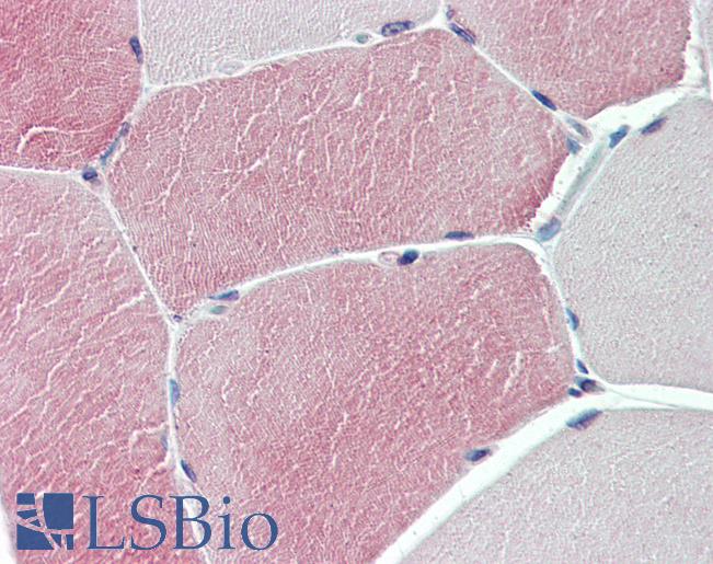 TXLNB Antibody - Anti-TXLNB antibody IHC of human skeletal muscle. Immunohistochemistry of formalin-fixed, paraffin-embedded tissue after heat-induced antigen retrieval.