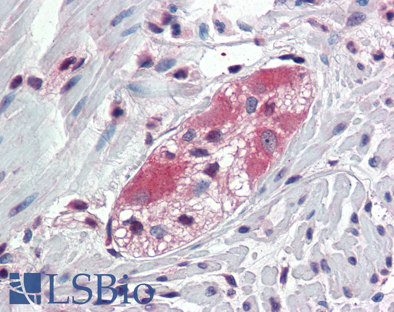 TXLNB Antibody - Anti-TXLNB antibody IHC of human colon, ganglion cells. Immunohistochemistry of formalin-fixed, paraffin-embedded tissue after heat-induced antigen retrieval.