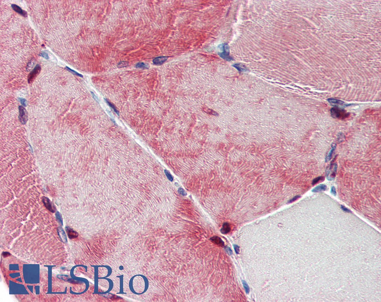TXLNB Antibody - Anti-TXLNB antibody IHC of human skeletal muscle. Immunohistochemistry of formalin-fixed, paraffin-embedded tissue after heat-induced antigen retrieval.