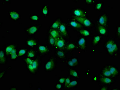TXN / Thioredoxin / TRX Antibody - Immunofluorescence staining of Hela cells with TXN Antibody at 1:100, counter-stained with DAPI. The cells were fixed in 4% formaldehyde, permeabilized using 0.2% Triton X-100 and blocked in 10% normal Goat Serum. The cells were then incubated with the antibody overnight at 4°C. The secondary antibody was Alexa Fluor 488-congugated AffiniPure Goat Anti-Rabbit IgG(H+L).