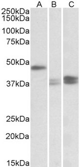 TXNDC5 / ERP46 Antibody - Goat Anti-TXNDC5 (aa269-282) Antibody (0.1µg/ml) staining of Mouse Lymph Nodes (A), Stomach (B) and Intestine (C) lysates (35µg protein in RIPA buffer). Detected by chemiluminescencence.
