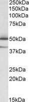 TXNDC5 / ERP46 Antibody - TXNDC5 antibody (0.05 ug/ml) staining of Human Lymph Nodes lysate (35 ug protein/ml in RIPA buffer). Primary incubation was 1 hour. Detected by chemiluminescence.