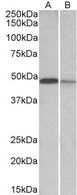 TXNDC5 / ERP46 Antibody - Goat Anti-TXNDC5 (aa281-295) Antibody (0.1µg/ml) staining of Mouse Lymph Nodes (A) and Mouse Intestine (B) lysates (35µg protein in RIPA buffer). Detected by chemiluminescencence.